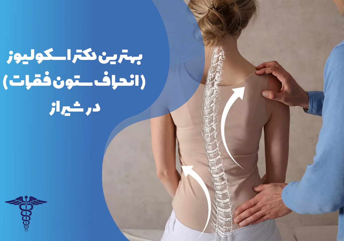 معرفی بهترین دکتر اسکولیوز در شیراز