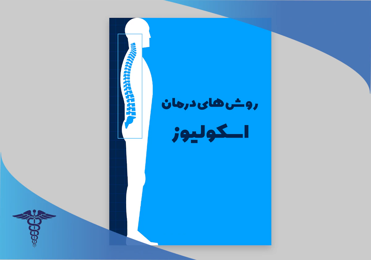 بهترین دکتر برای درمان اسکولیوز در شیراز