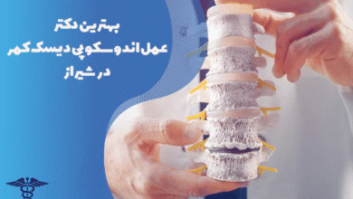 معرفی بهترین دکتر عمل اندوسکوپی دیسک کمر در شیراز