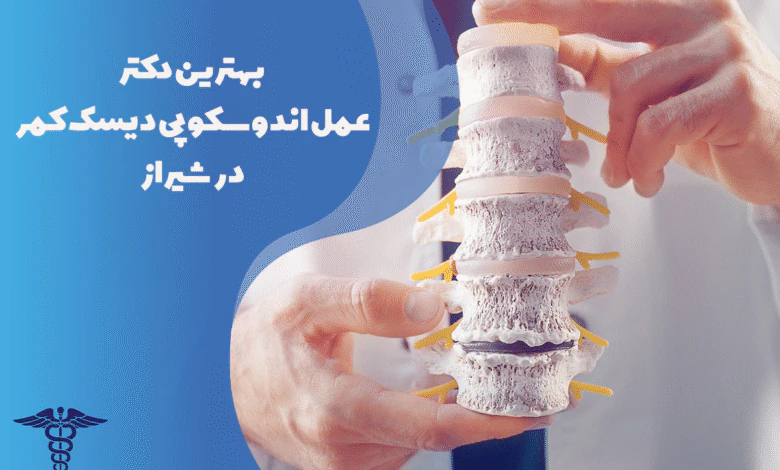 معرفی بهترین دکتر عمل اندوسکوپی دیسک کمر در شیراز