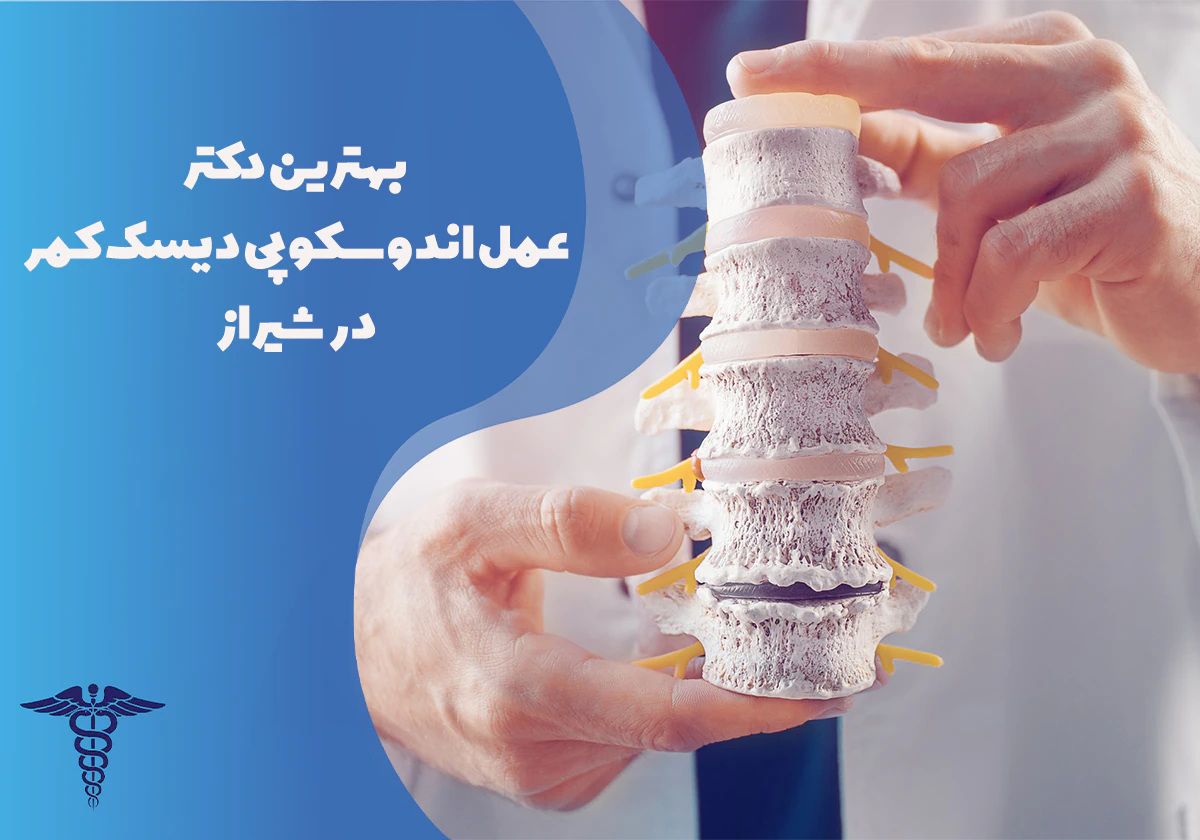 معرفی بهترین دکتر عمل اندوسکوپی دیسک کمر در شیراز