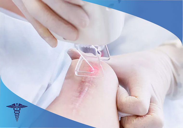 درمان اسکار در شهر صدرا شیراز