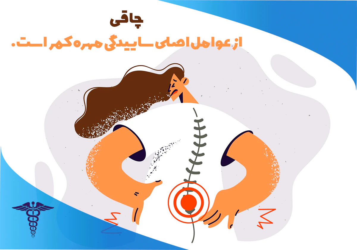 چاقی یکی از مهم ترین دلایل فرسایش مهره ها و عامل تشدید کننده عوارض ساییدگی مهره کمر است.