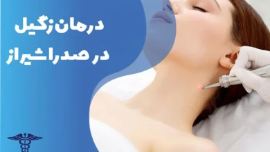 دکتر درمان زگیل در صدرا شیراز