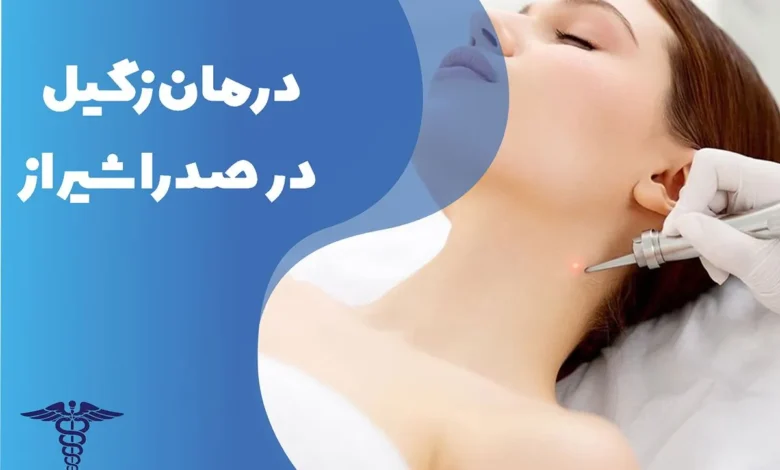 دکتر درمان زگیل در صدرا شیراز