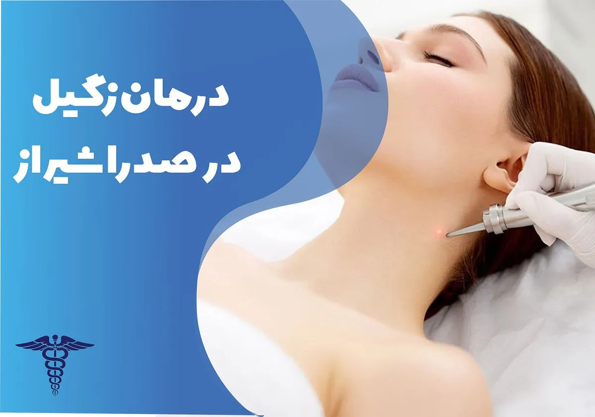 دکتر درمان زگیل در صدرا شیراز