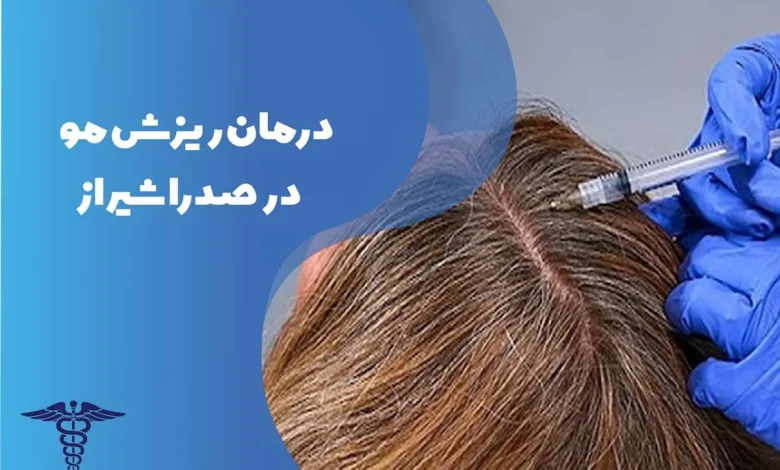 دکتر درمان ریزش مو در صدرا شیراز