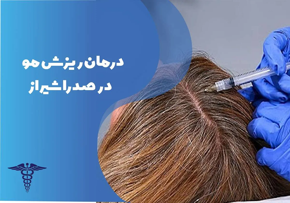 دکتر درمان ریزش مو در صدرا شیراز