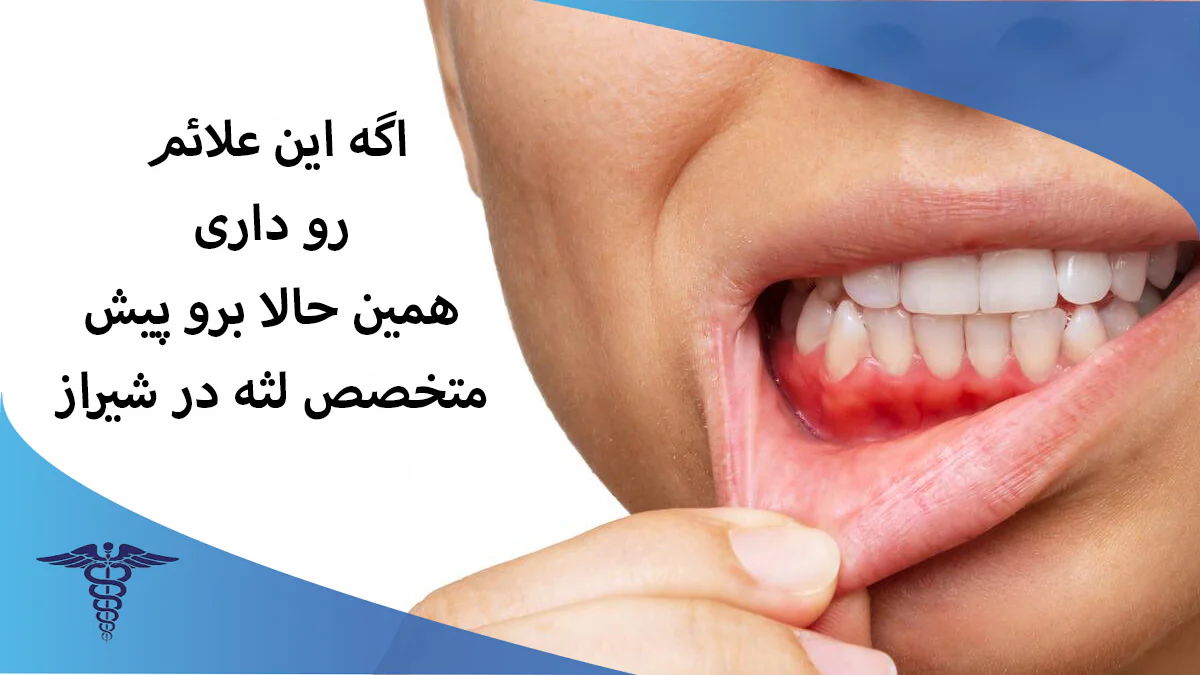 علائم مراجعه به متخصص لثه در شیراز
