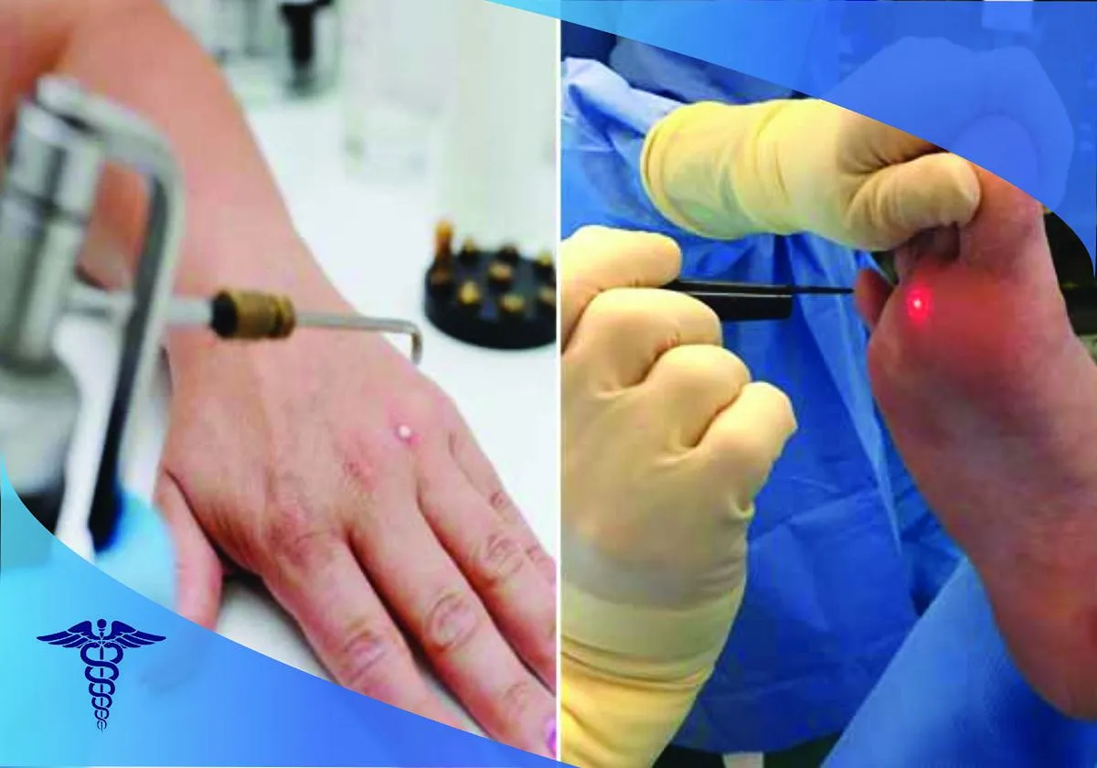 بهترین دکتر زنان برای زگیل در شیراز