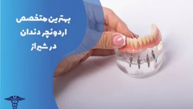 لیست 22 تا از بهترین متخصص اوردنچر دندان در شیراز