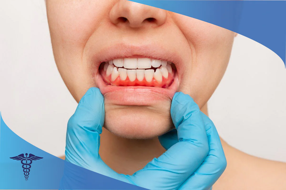 تفاوت متخصص لثه با دندانپزشک در شیراز