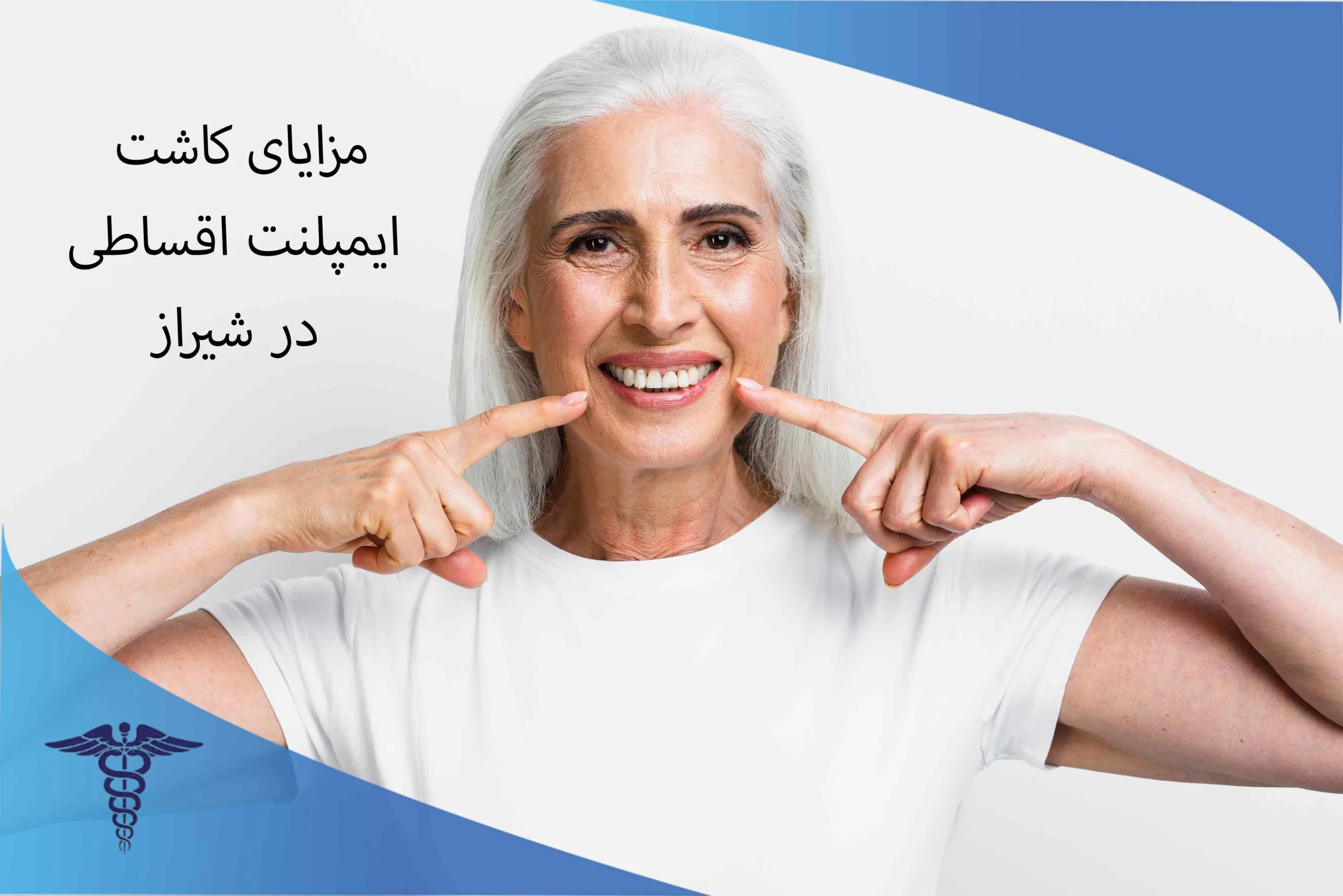 مزایای کاشت ایمپلنت قسطی در شیراز