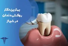معرفی 30 دکتر روکش دندان در شیراز
