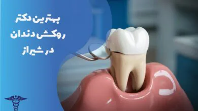 معرفی 30 دکتر روکش دندان در شیراز