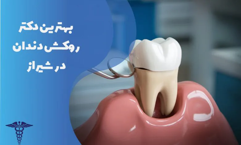 معرفی 30 دکتر روکش دندان در شیراز