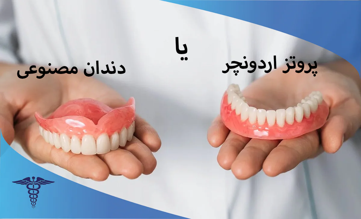 پروتز اوردنچر در شیراز بهتر است یا دندان مصنوعی؟