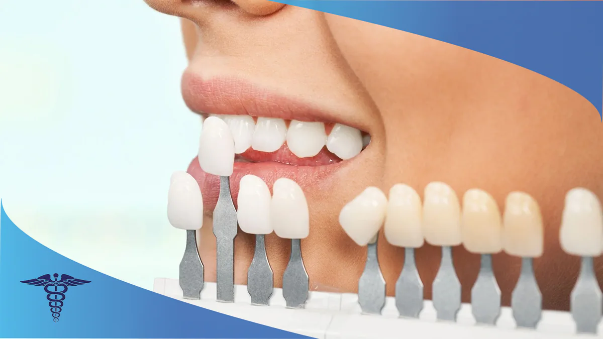 کلینیک دندانپزشکی برای لمینت اقساطی شیراز