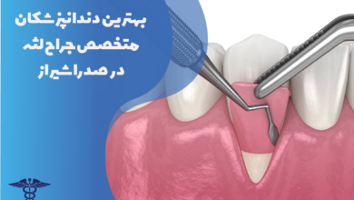 بهترین دندانپزشکان متخصص جراح لثه در صدرا شیراز