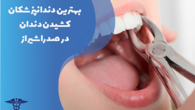 بهترین دندانپزشکان کشیدن دندان در صدرا شیراز