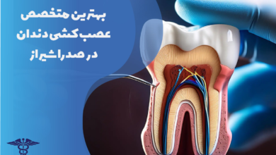 بهترین متخصص عصب‌کشی دندان در صدرا شیراز