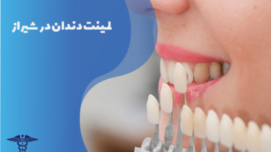 لمینت دندان در شیراز