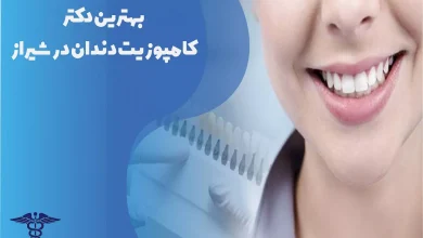 بهترین دکتر کامپوزیت دندان در شیراز