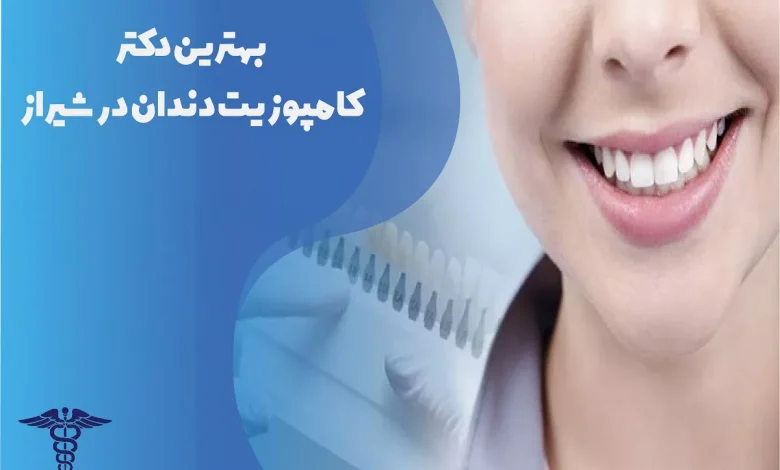 بهترین دکتر کامپوزیت دندان در شیراز