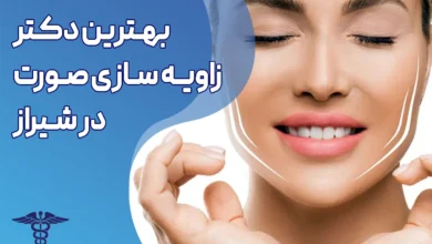 بهترین دکتر زاویه سازی صورت در شیراز