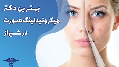 بهترین دکتر میکرونیدلینگ صورت در شیراز