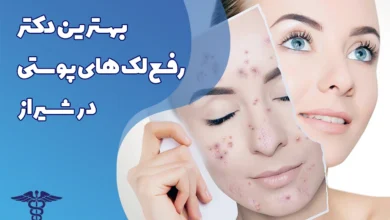20 تا بهترین دکتر رفع لک های پوستی در شیراز