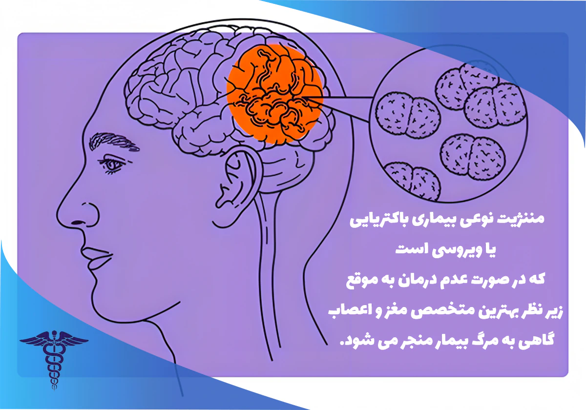 درمان بیماری مننژیت در شیراز؛ دلایل اهمیت درمان بهموقع