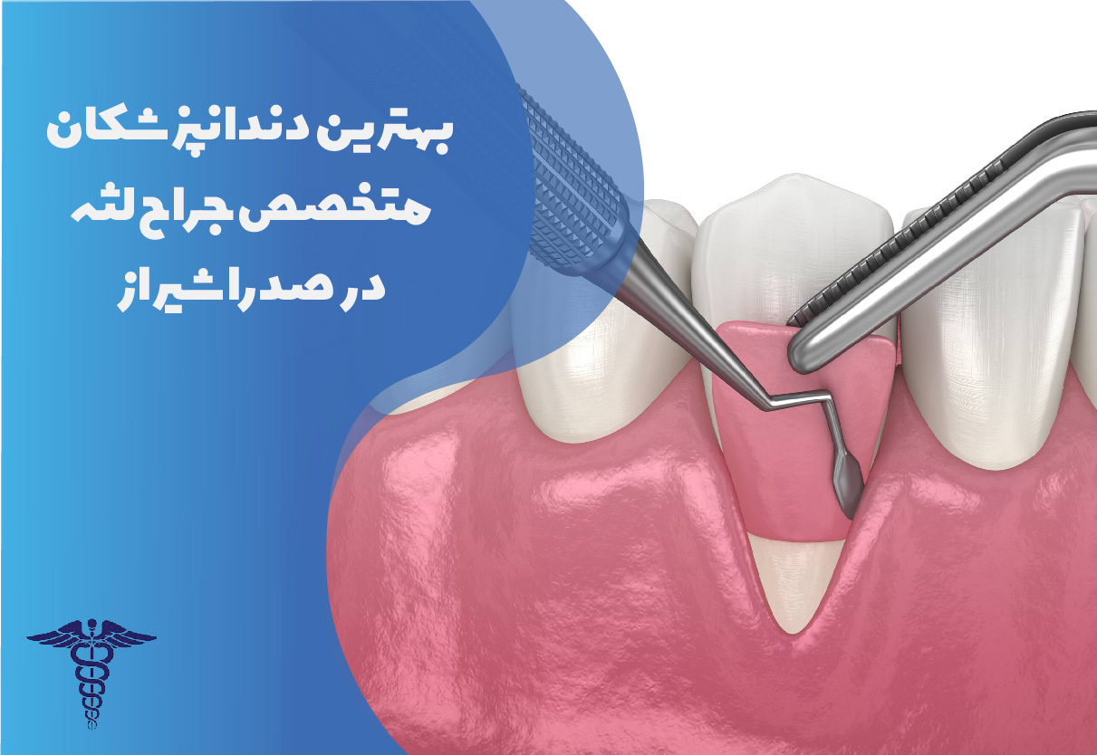 بهترین دندانپزشکان متخصص جراح لثه در صدرا شیراز