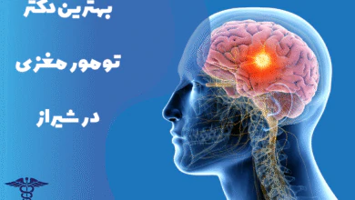 معرفی بهترین دکتر تومور مغزی در شیراز