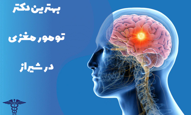 معرفی بهترین دکتر تومور مغزی در شیراز