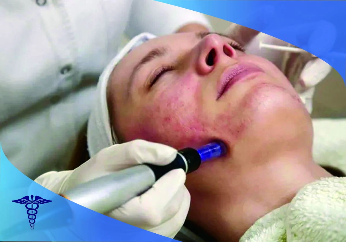 بهترین کلینیک رفع لک های پوستی در شیراز