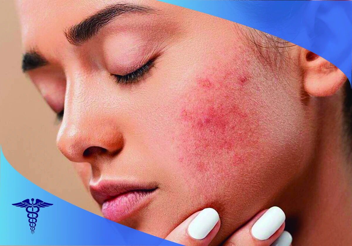 بهترین دکتر رفع لک های پوستی در شیراز