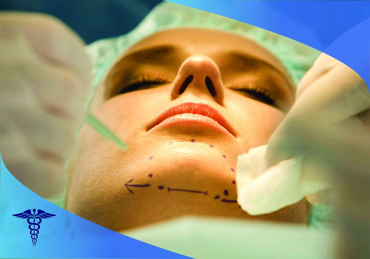 بهترین دکتر زاویه سازی صورت در شیراز
