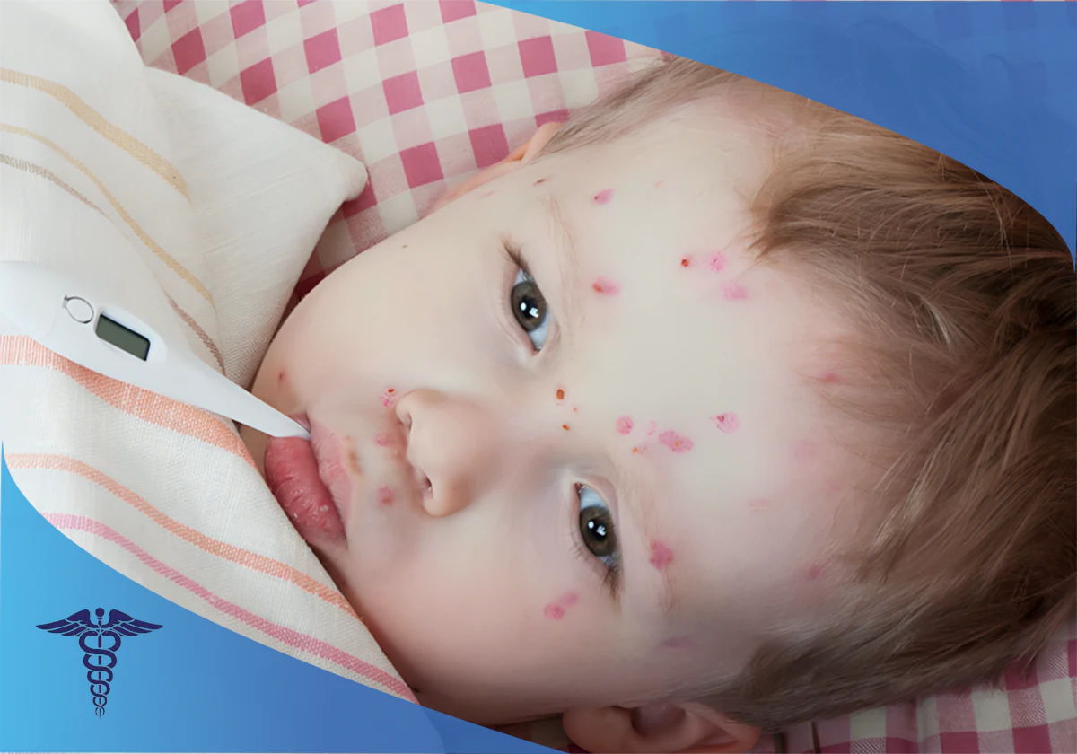 درمان بیماری مننژیت در شیراز؛ بیماری مننژیت چیست؟