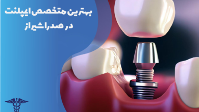 بهترین متخصص ایمپلنت در صدرا شیراز