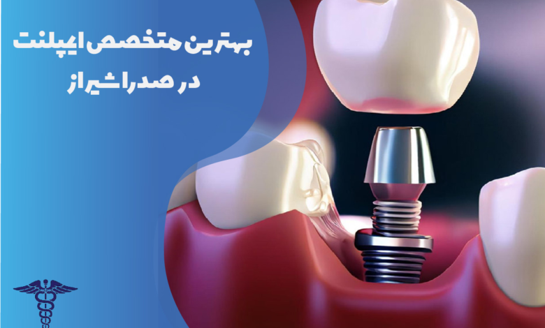 بهترین متخصص ایمپلنت در صدرا شیراز