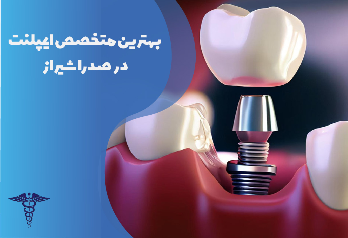 بهترین متخصص ایمپلنت در صدرا شیراز