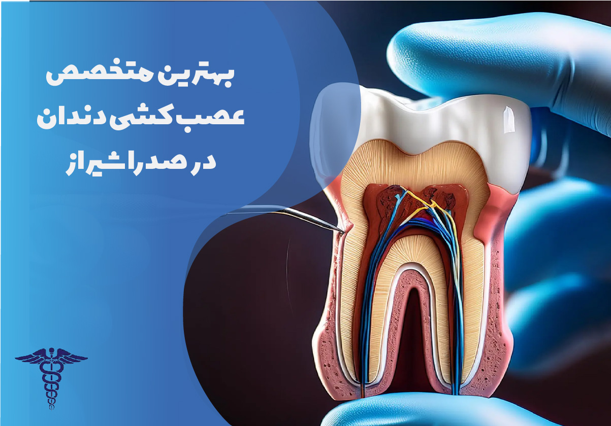 بهترین متخصص عصب‌کشی دندان در صدرا شیراز