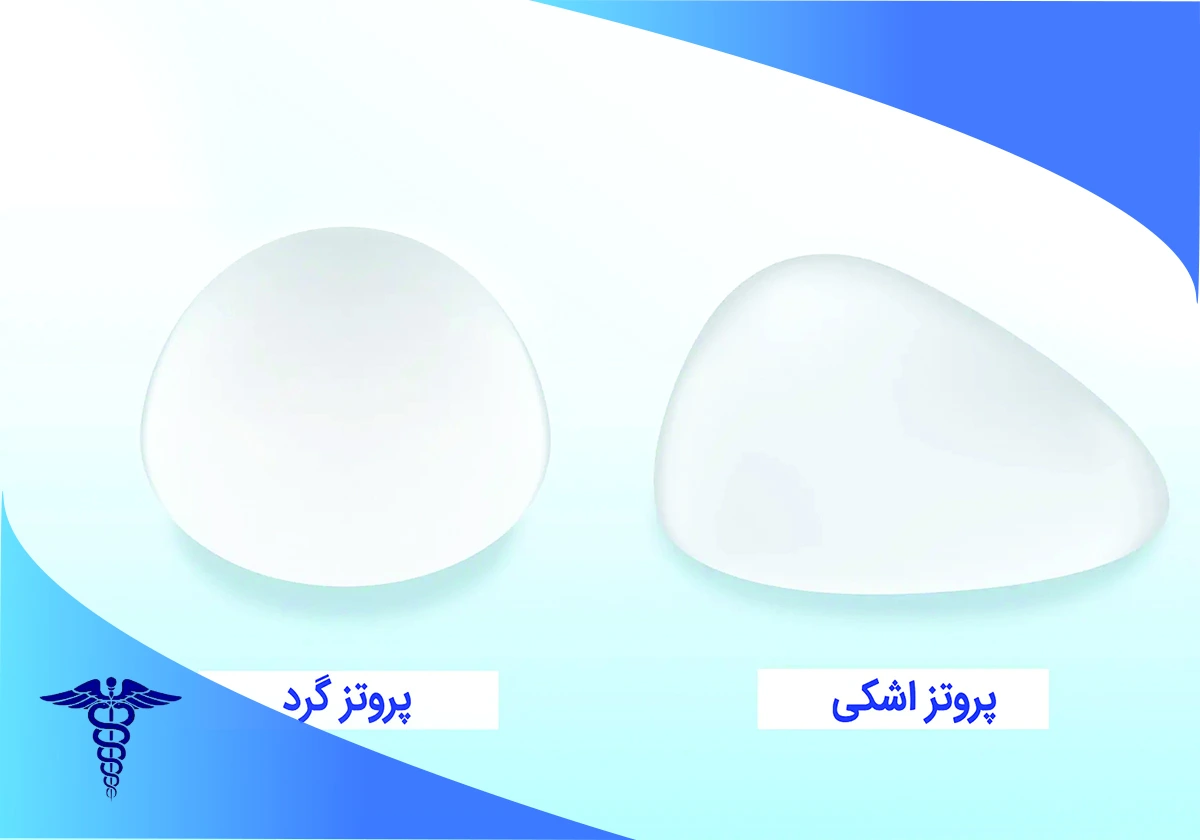 پروتز سینه در شیراز