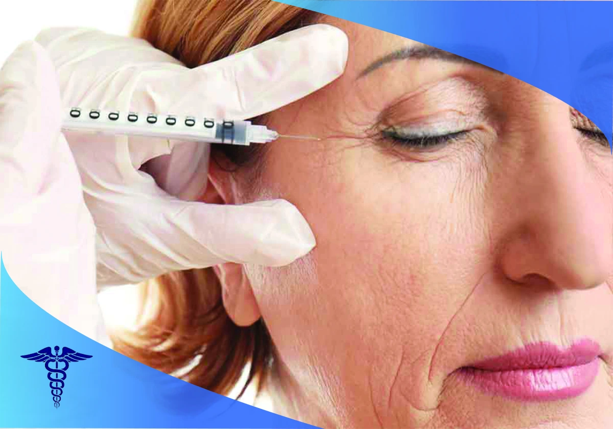 ویژگی ‌های بهترین پزشک تزریق بوتاکس در شیراز