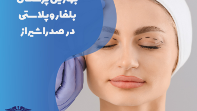 بهترین پزشکان بلفاروپلاستی در صدرا شیراز