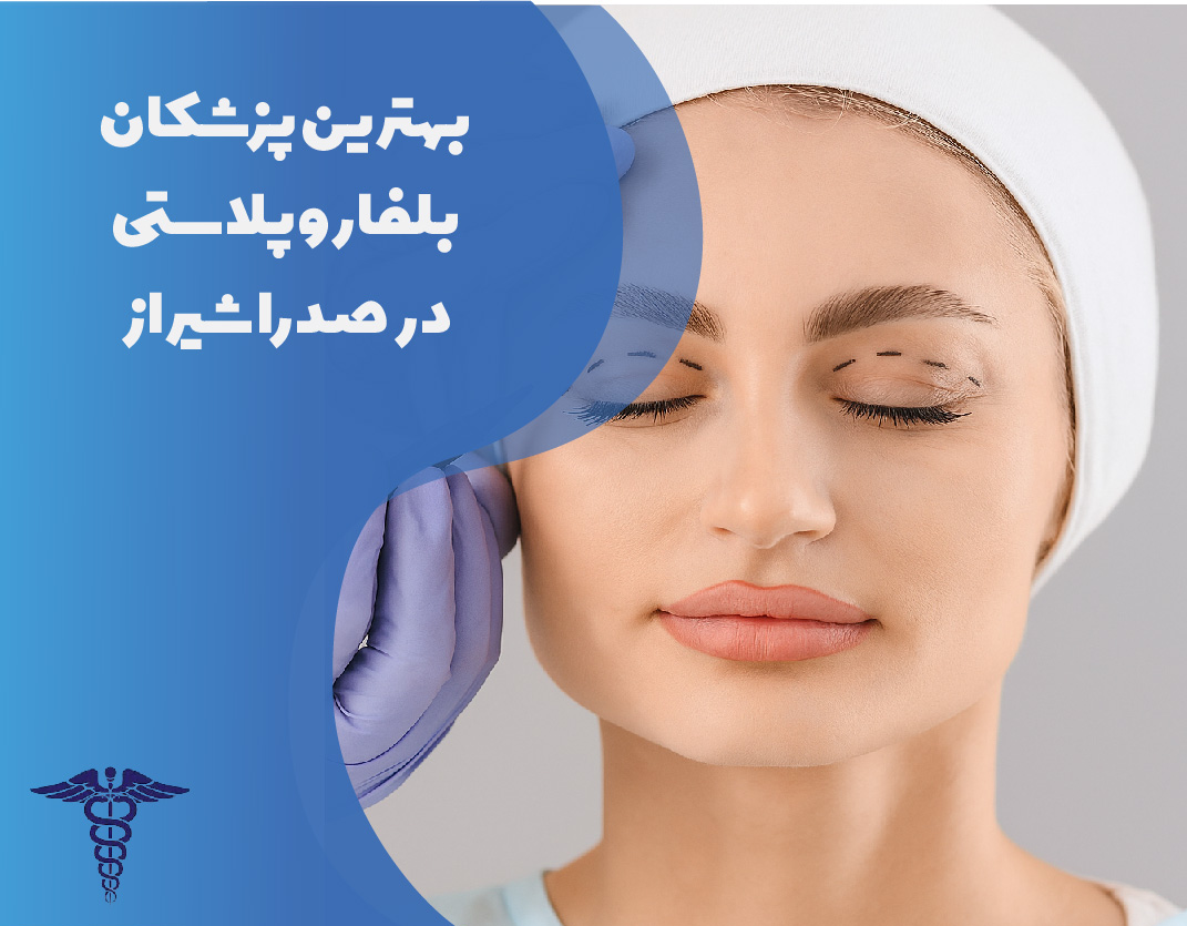 بهترین پزشکان بلفاروپلاستی در صدرا شیراز