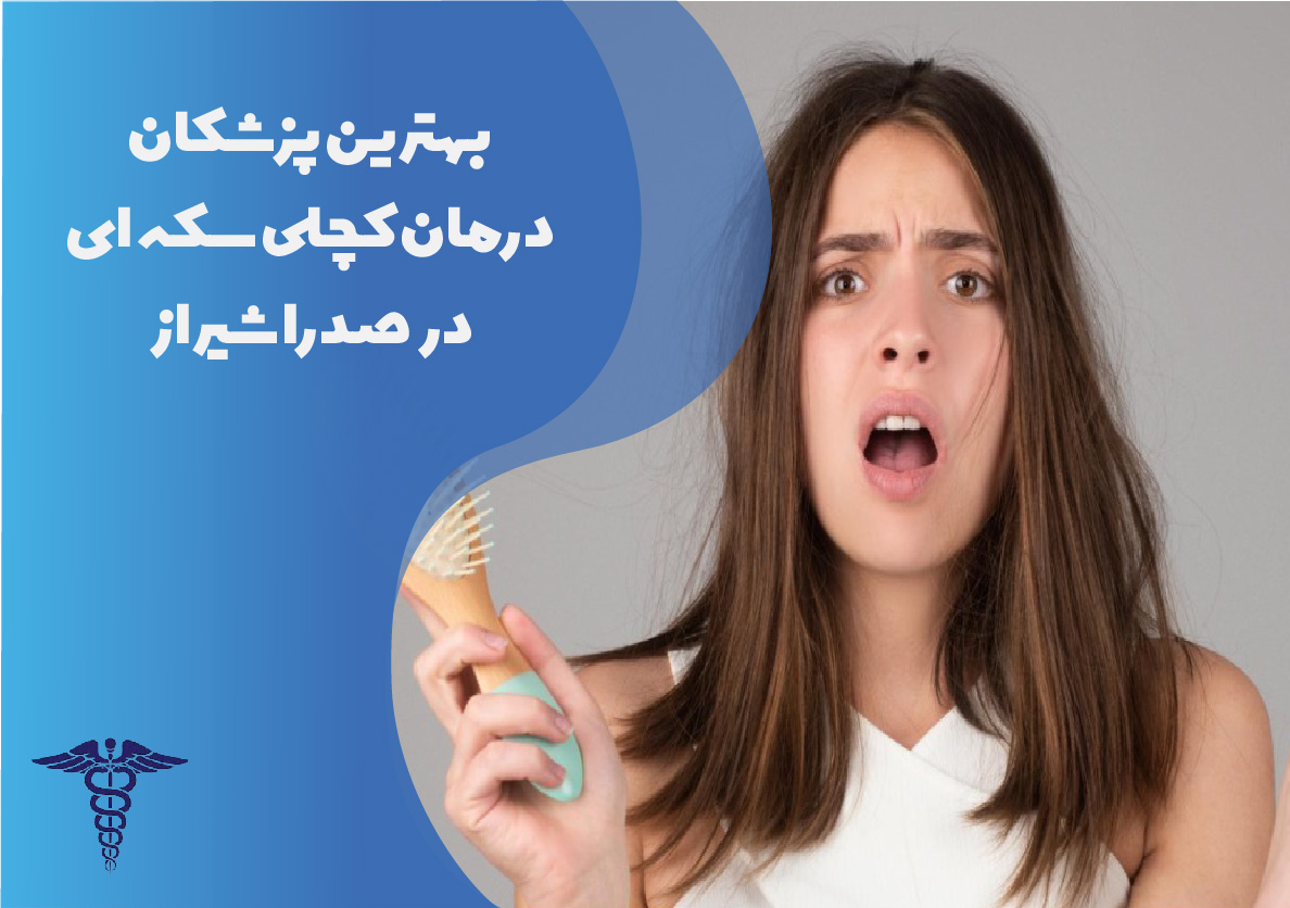 بهترین پزشکان درمان کچلی سکه‌ای در صدرا شیراز