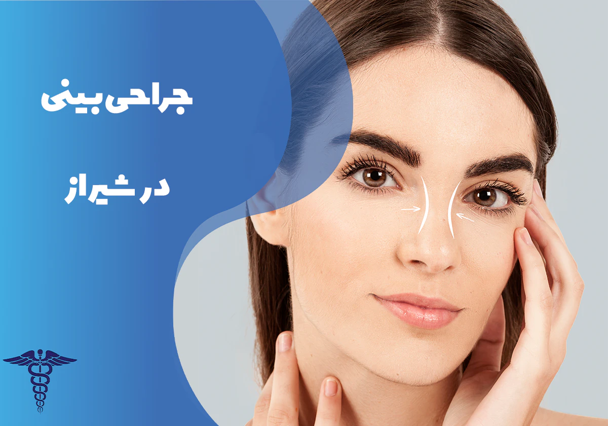 راهنمای جراحی بینی در شیراز