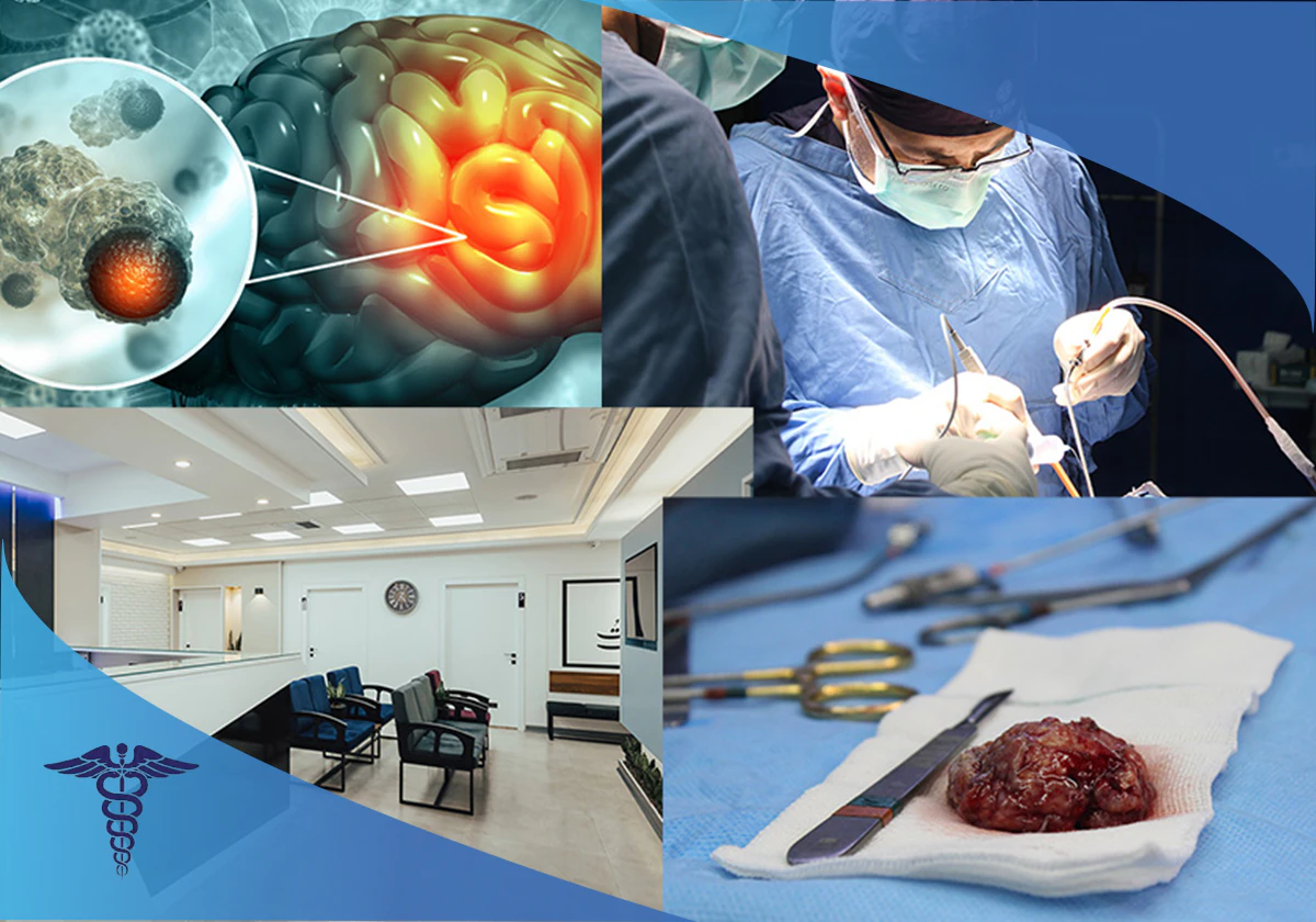 درمان تومور مغزی کودکان در شیراز